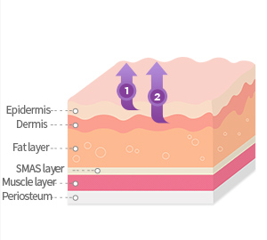 Epidermis, Dermis, Fat layer, SMAS layer, Muscle layer, Periosteum