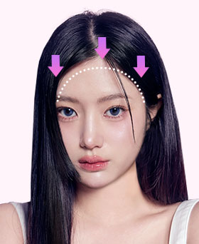 Step 3: Pull scalp