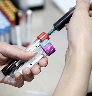 PRP Fat Grafting
