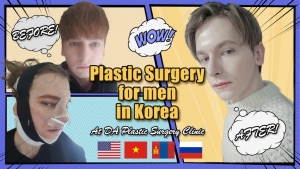 Real plastic surgery review of model Adam in Korea!
